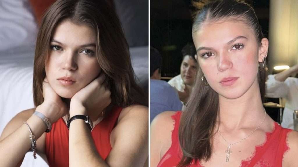 Valentina Gilabert muestra cicatriz tras brutal ataque de Marianne “N”