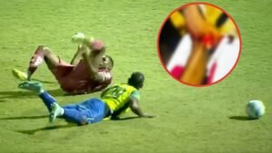 Romario Da Silva lesión tobillo