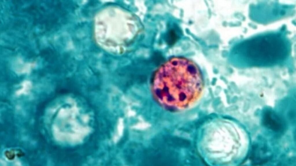 Cyclospora México
