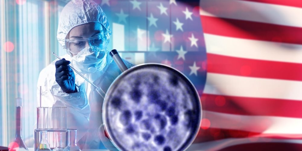 Brote Cyclospora Estados Unidos