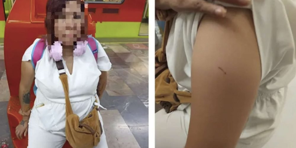 Metro CDMX: nuevo caso de pinchazo con aguja reaviva el miedo