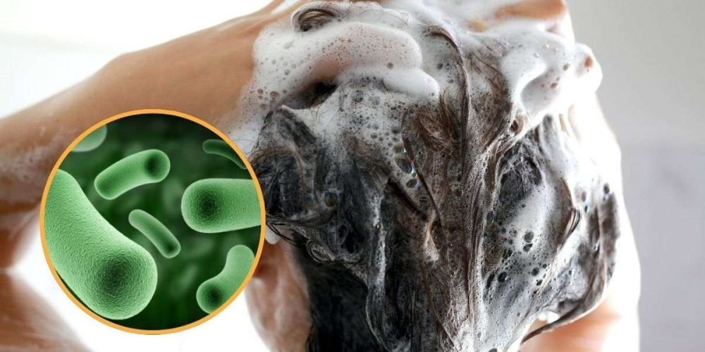 alerta-profeco-bacteria-champu