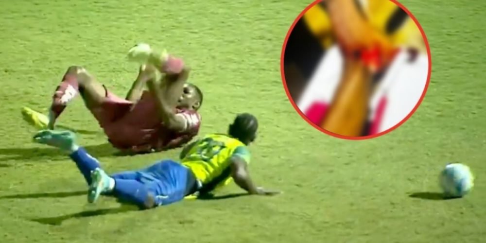 Romario Da Silva lesión tobillo