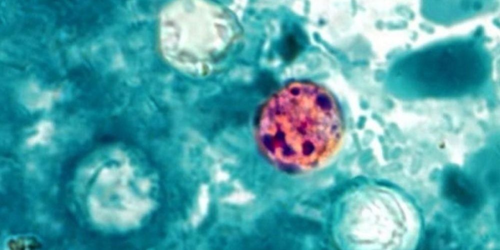 Cyclospora México