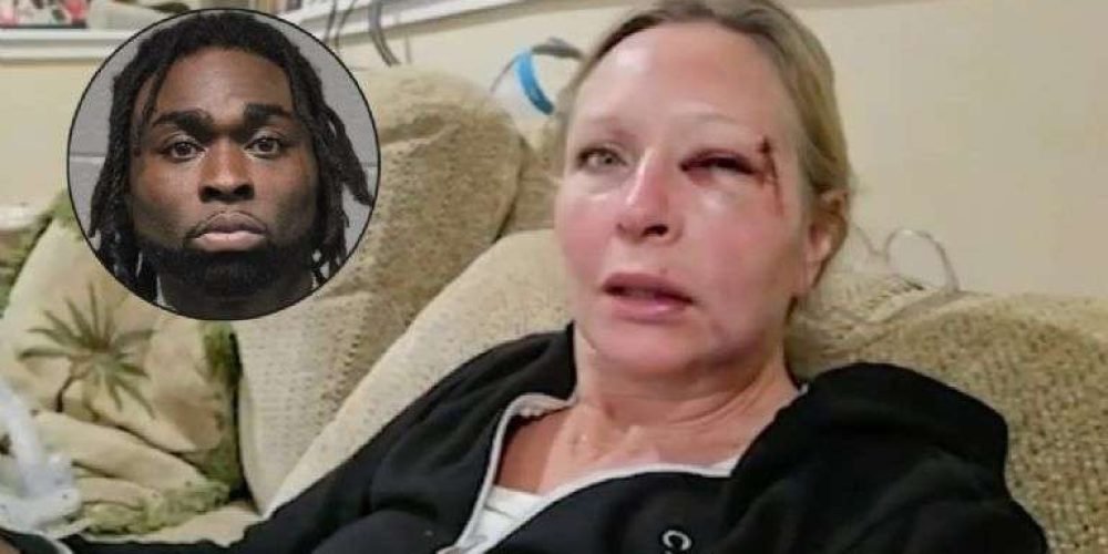 golpeador-serial-fractura-madre-ataque-rostro