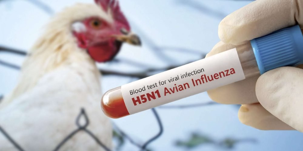 Confirman muerte de menor contagiada con influenza aviar