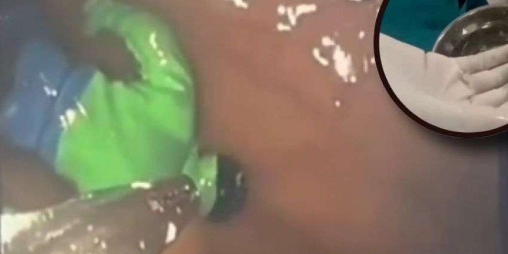 hulk-niño-dolor-estomacal