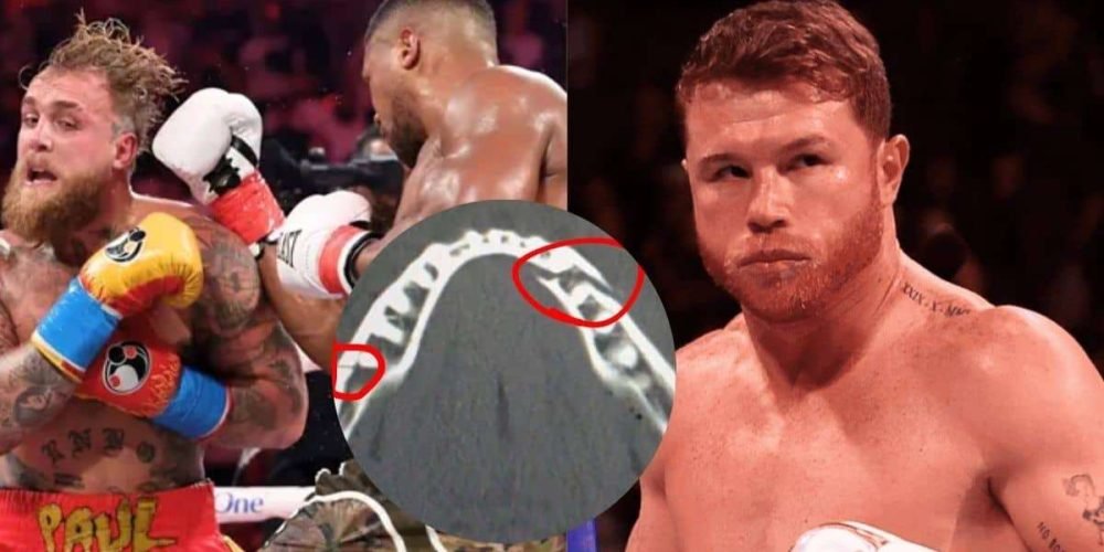 jake-paul-doble-fractura-mandibula-ahora-reta-al-canelo-alvarez