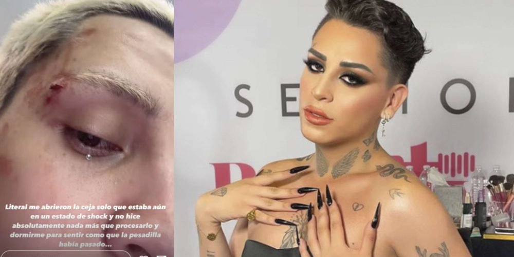Golpean a Kunno en Monterrey tras insultos homofóbicos
