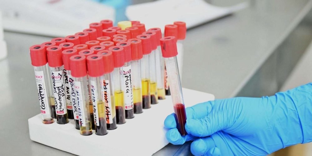 programa-gratuito-de-detección-de-cáncer-de-próstata